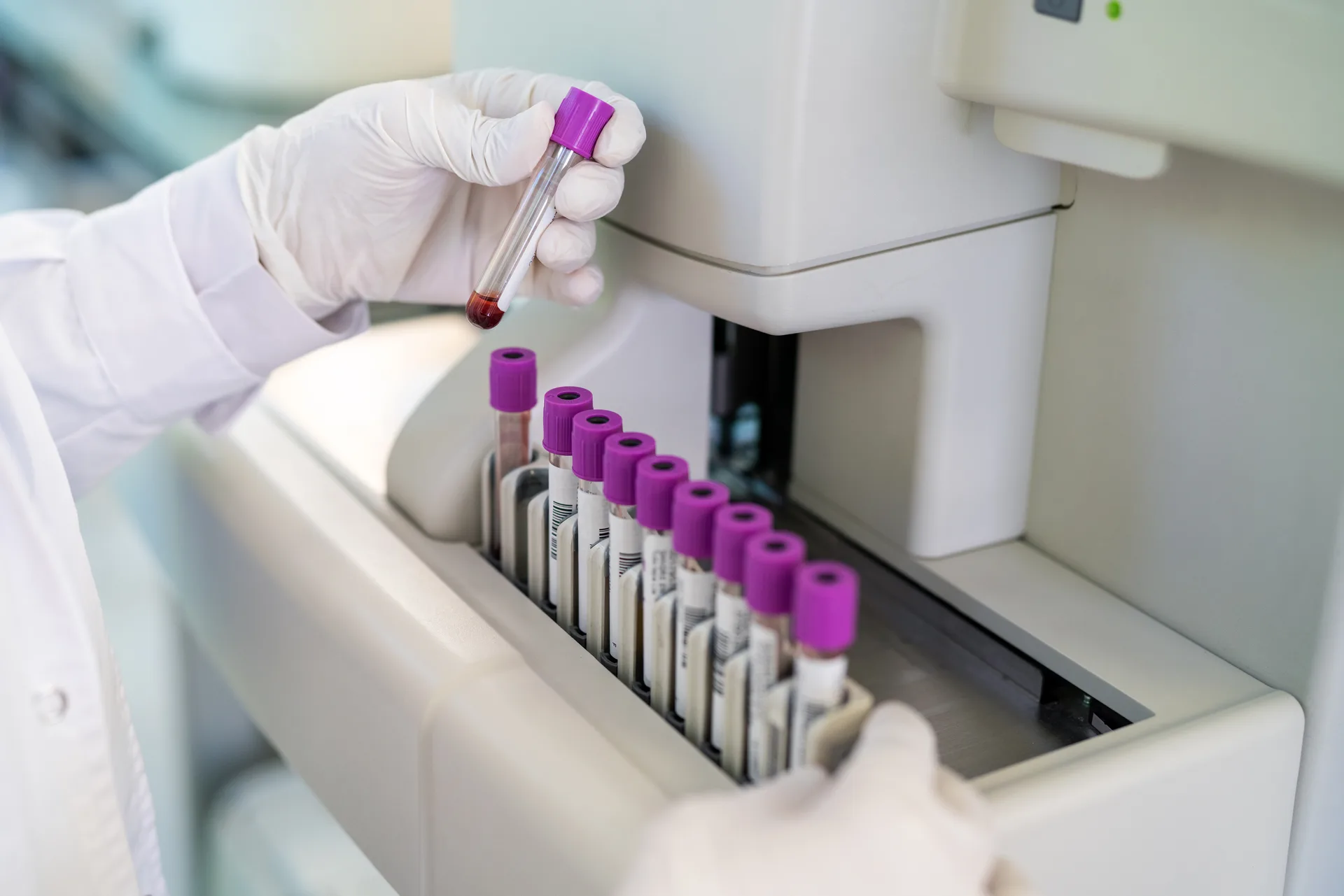 Close-up of a doctor gloves working in a testing laboratory